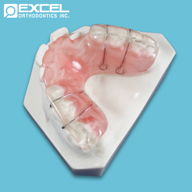 Bite Plane Braces: Price, Uses & More 2 - Bite Plane Braces: Price, Uses & More Bite Plane Braces: Price, Uses More