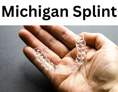 Michigan Splint: A Comprehensive Guide 4 - Michigan Splint: A Comprehensive Guide Michigan Splint: A Comprehensive Guide