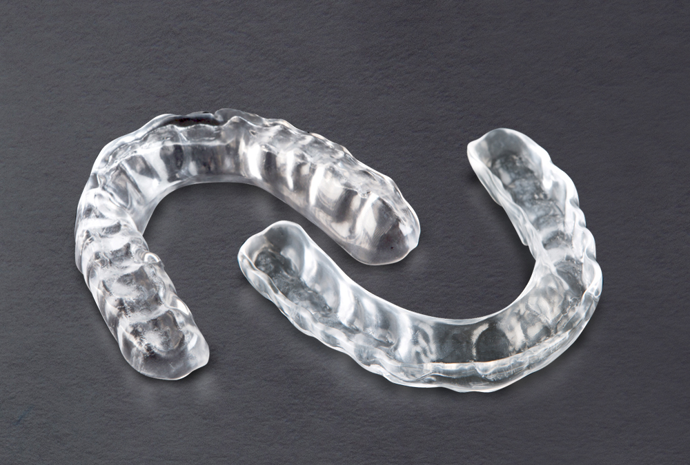 Understanding Occlusal Night Guard Splints 3 - Understanding Occlusal Night Guard Splints Understanding Occlusal Night Guard Splints