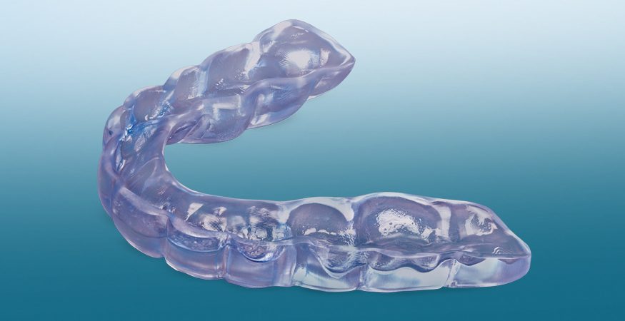 Understanding Occlusal Night Guard Splints 5 - Understanding Occlusal Night Guard Splints Understanding Occlusal Night Guard Splints