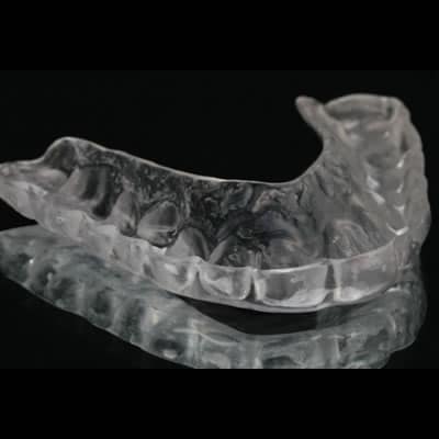 Understanding Occlusal Night Guard Splints 4 - Understanding Occlusal Night Guard Splints Understanding Occlusal Night Guard Splints