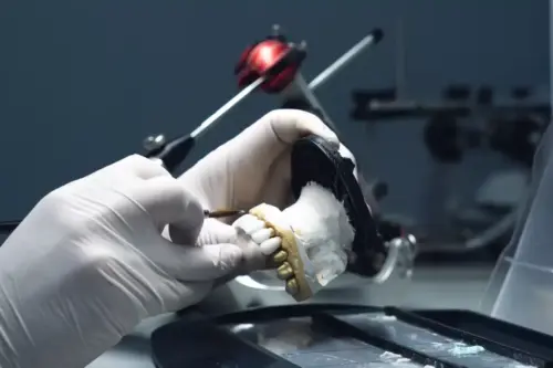 what is dental lab 2 - Dental Laboratory: What It Is & Its Role in Modern Dentistry - World Dental Lab