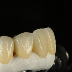 Hybrid Biohpp CADCAM Bioplastic 2 - World Dental Lab - World Dental Lab