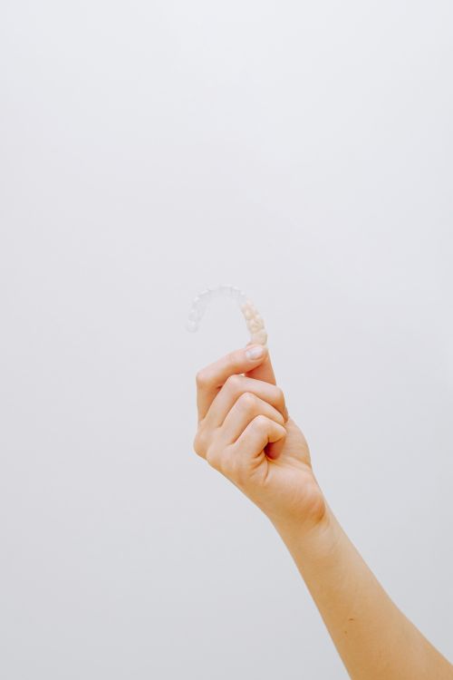 Clear Dental Aligner — Transparent Orthodontic Appliance Fabricated by Dental Lab Clear dental aligner transparent orthodontic tray — fabricated by dental lab from digital scan data