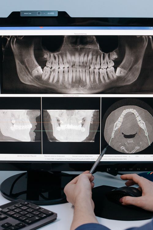 Digital dental scan STL file — US dental labs sending digital cases to offshore outsourcing lab in Vietnam