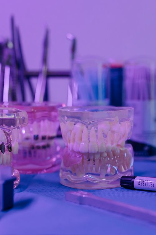 Diagnostic Wax-Up on Articulator — Dental Lab Planning Tool for Complex Restorations Diagnostic dental wax-up on articulator model — planning tool used before crown, bridge, and veneer fabrication in dental lab