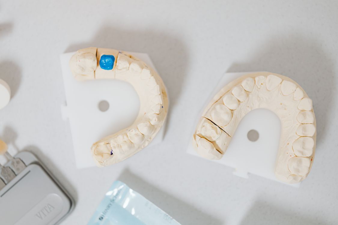 Dental crowns in a laboratory setting — comparing PFM and zirconia restoration materials