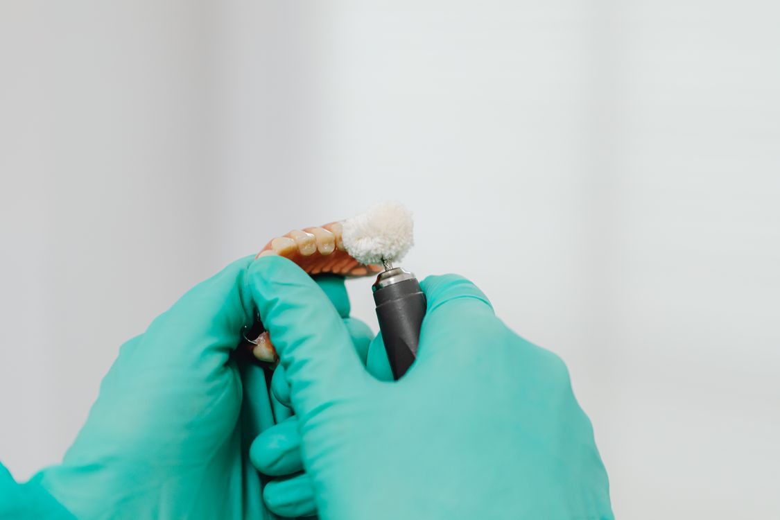 PMMA Temporary Bridge — Provisional Restoration in Digital Dental Workflow Dental provisional temporary bridge on model — PMMA acrylic temporary restoration in digital implant workflow