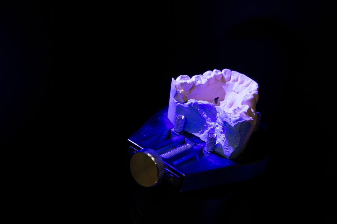 CAD/CAM PMMA Temporary Production — Digital Dental Lab Milling Process CAD/CAM milling machine producing PMMA temporary restoration — digital dental lab workflow for temporaries