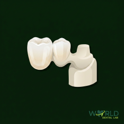 Zirconia Cantilever Bridge (Layered)