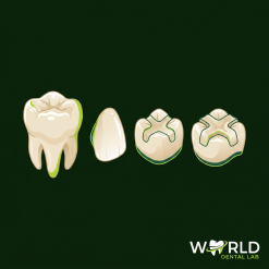 Ceramic Resin Crown/Veneer/Inlay/Onlay (PV3 Ceramage)