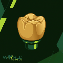 Full Cast 18k Gold Crown