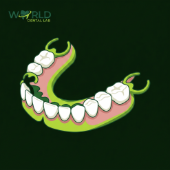 Flexible Partial Denture Duraplex - Finish After Try-In (max 7 teeth)