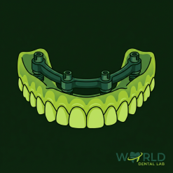 Full Arch Denture 1 Step - All on X (over 7 teeth)