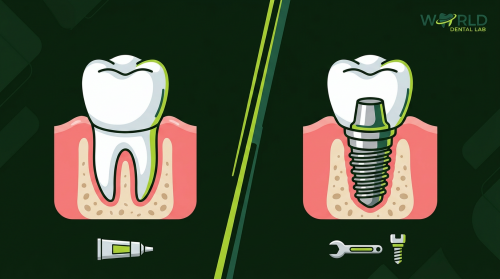 thumb 3823 - Implant Crown vs Regular Crown: Key Differences for Labs and Clinicians - World Dental Lab