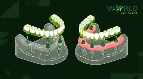 thumb 3907 1 - All-on-4 vs All-on-6 Dental Implants: What Dental Labs Need to Know - World Dental Lab