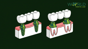 thumb 3925 1 - Implant-Supported Dental Bridge vs Traditional Bridge: Key Differences - World Dental Lab