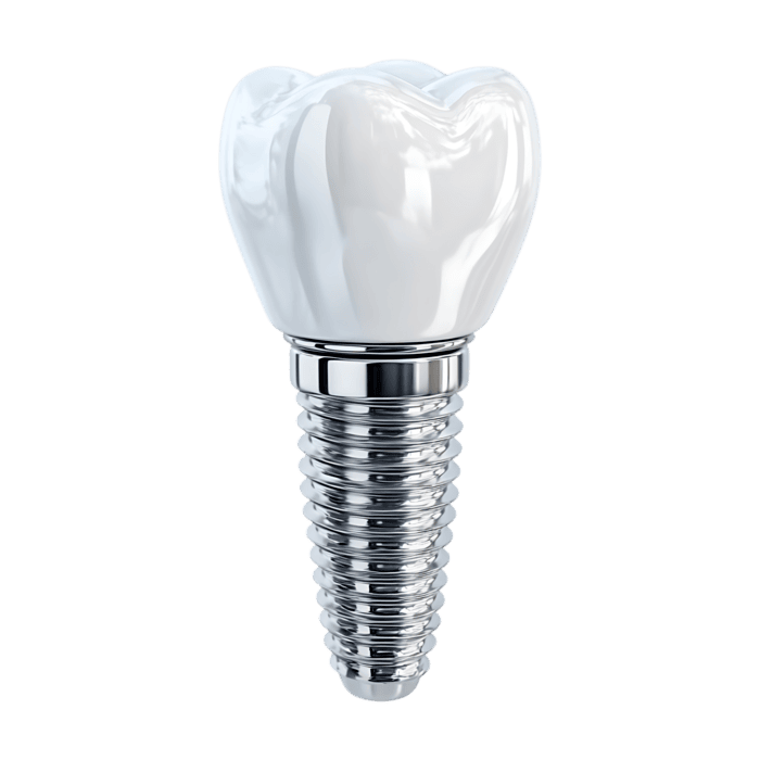 Single Unit Implant Crowns - Implant Dental Lab - World Dental Lab