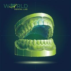 Orthodontic Model