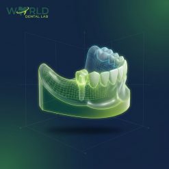 Implant Tissue Model