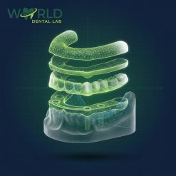 Stackable Guide 4 Implants