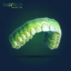 Diagnostic Waxup per Arch (over 7 units)