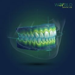 Diagnostic Waxup with Patient Photo