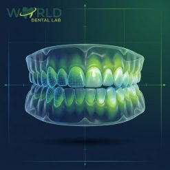 Orthodontic Sequential Aligner Treatment Plan
