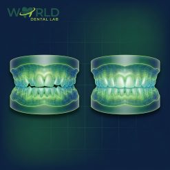 Orthodontic Before/After Model