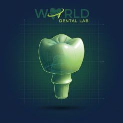 Cement Retained Full Contour Implant
