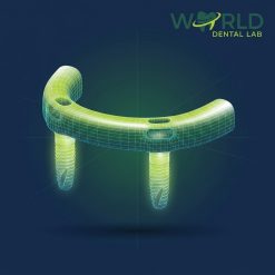 Implant IBar