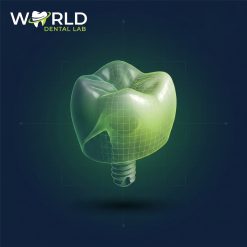 Implant Temporary Crown