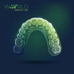 Smile Design Prep Guide